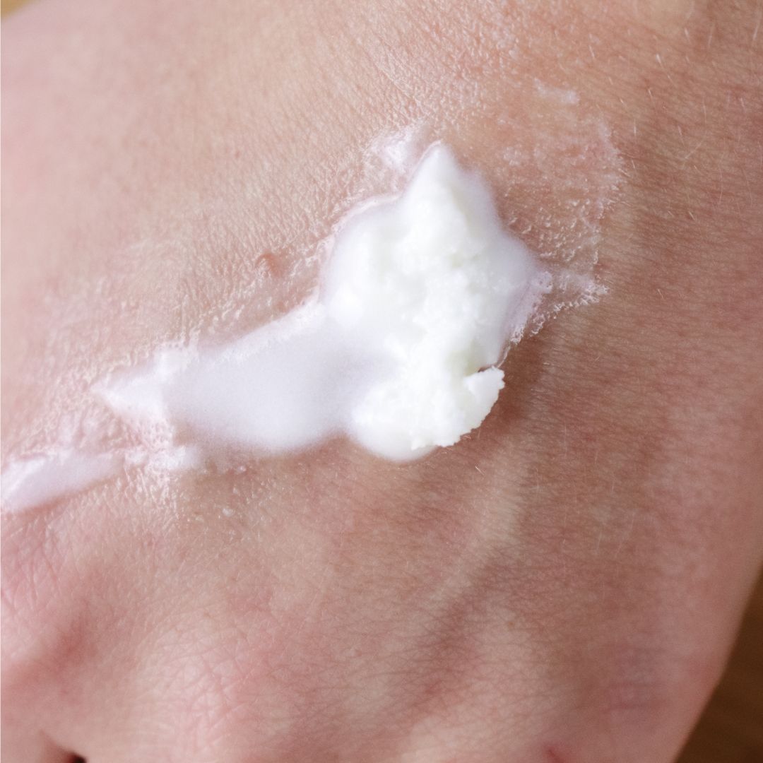 Close-up of a hand applying white cream to skin